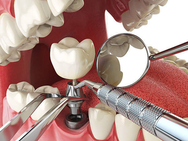 Best Broken or Cracked Tooth Emergency Dentist in Farwell, TX